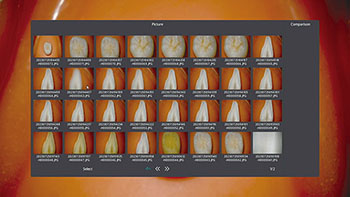 サムネイル表示