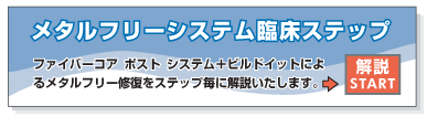 『ファイバーコア ポスト』+『ビルドイット』臨床ステップ解説